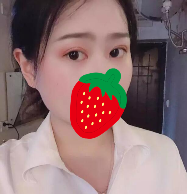 铜陵晶美医疗美容门诊部做双眼皮和开眼角怎么样