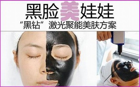 去黑头黑脸娃娃多少钱