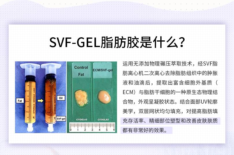 svf脂肪胶填充是什么