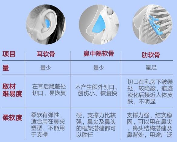 深圳四季医疗美容医院科普软骨隆鼻