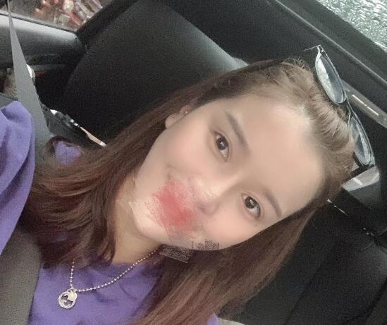 贾德渊医生做鼻子案例分享