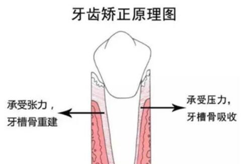 杭州市第三人民医院口腔科科普牙齿矫正