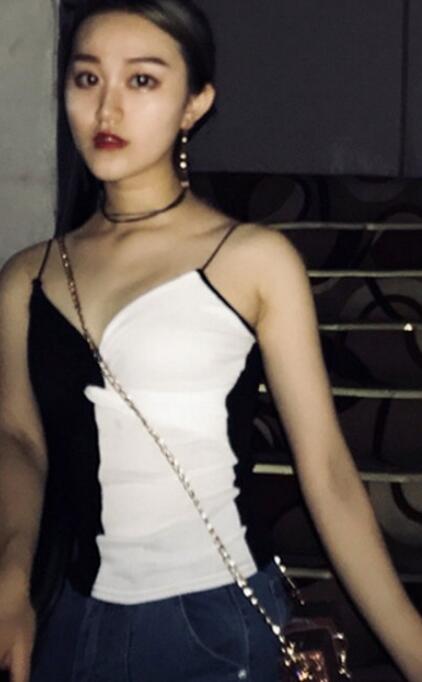 滨州医学院附属医院吸脂案例分享