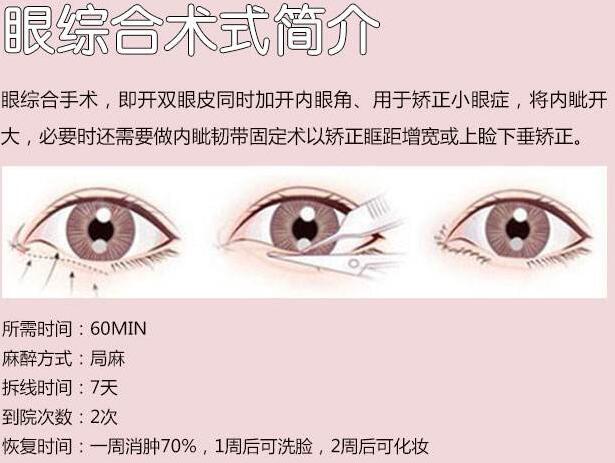 广州海峡整形美容医院科普双眼皮手术