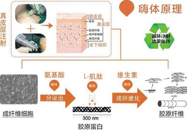 嗨体注射脖子除皱