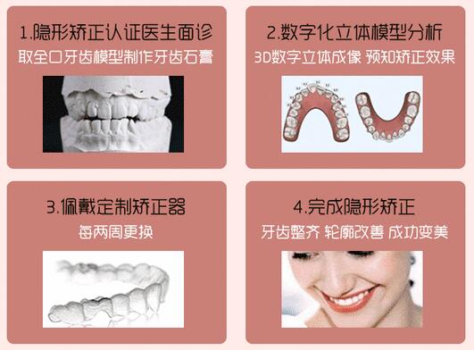 矫正牙齿的方式有几种?