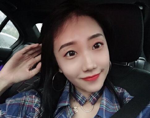 温州和平整形医院祛眼袋案例分享