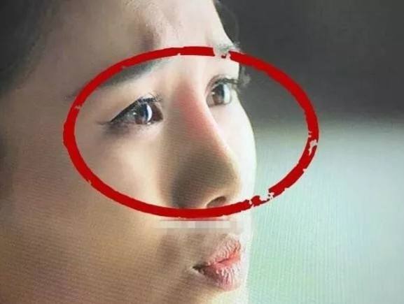 硅胶隆鼻的副作用