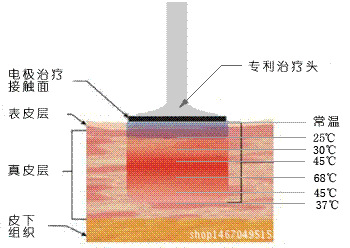 电波拉皮果怎么样