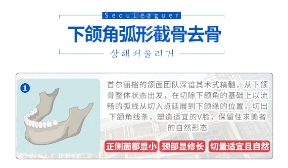 整瓜子脸需要多少钱