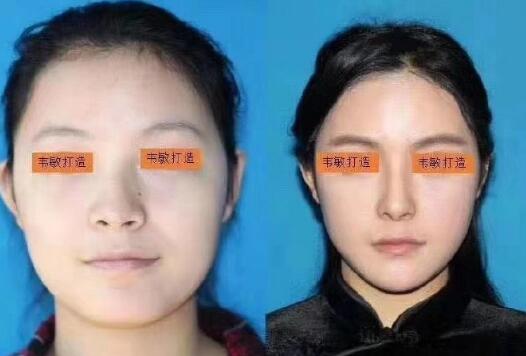 整瓜子脸果图