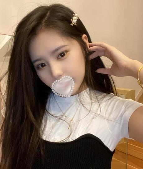 上海华美整形美容医院隆鼻案例