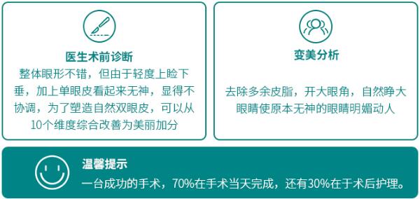 八大处甘承医生双眼皮手术科普
