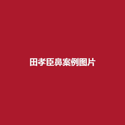 华西许学文做双眼皮的技术怎么样呢?实力可不可靠呢?内附案例介绍了解一下吧。