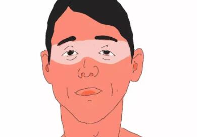 晒伤后皮肤发红怎么办01.jpg
