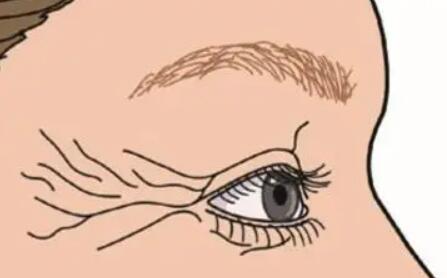 开外眼角动漫02.jpg 开外眼角动漫02.jpg