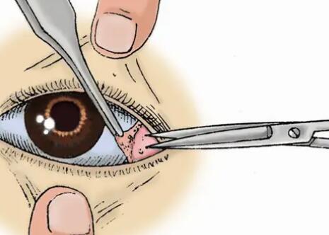 开外眼角动漫01.jpg 开外眼角动漫01.jpg