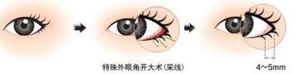 开外眼角动漫04.jpg 开外眼角动漫04.jpg