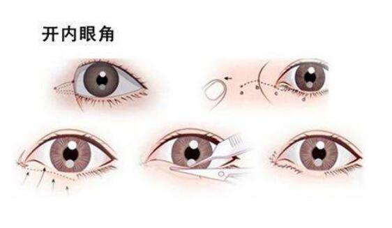 开眼角动漫06.jpg 开眼角动漫06.jpg