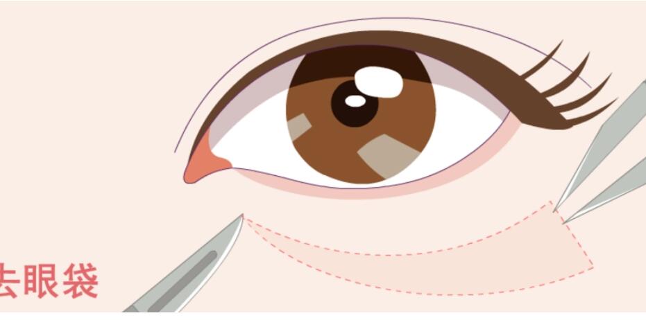 去眼袋动漫41.jpg 去眼袋动漫41.jpg