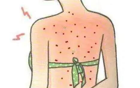 背上祛痘动漫03.jpg 背上祛痘动漫03.jpg