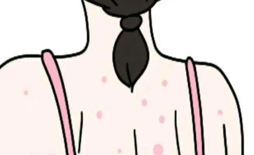 背上祛痘动漫01.jpg 背上祛痘动漫01.jpg