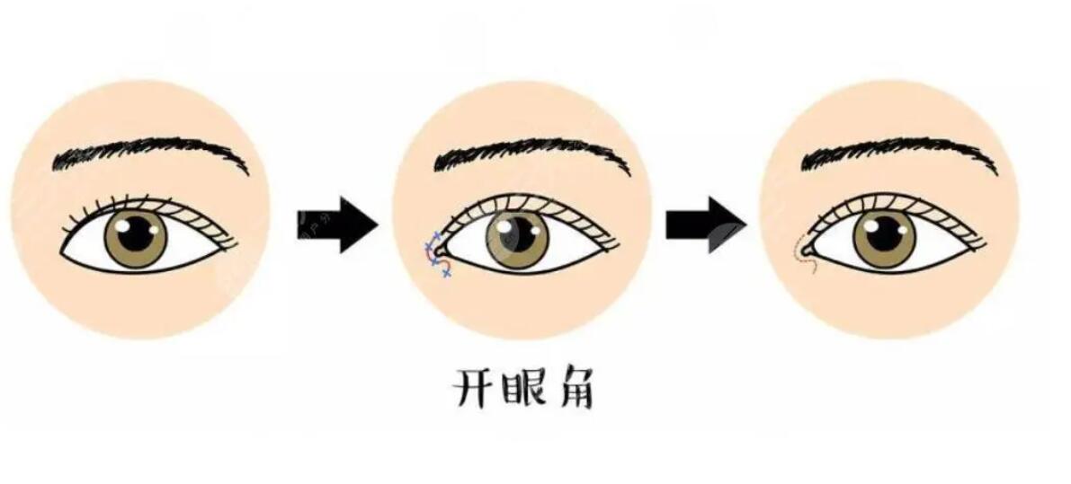 开眼角动漫.jpg