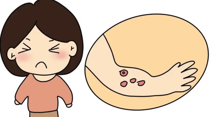 烫伤后起水泡03.jpg 烫伤后起水泡03.jpg