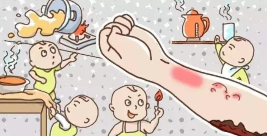 烫伤后起水泡04.jpg 烫伤后起水泡04.jpg