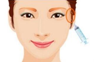 填充太阳穴动漫.jpg 填充太阳穴动漫.jpg