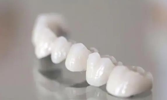 全瓷牙hg03.jpg 全瓷牙hg03.jpg