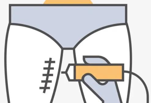 大腿吸脂dm04.jpg 大腿吸脂dm04.jpg