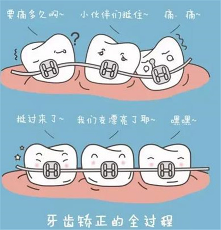 重庆华诺世口腔正畸怎么样?重庆华诺正畸好不好？跟大家分享下我正畸的体验与收费价格！