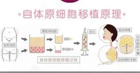 自体脂肪填充后吃哪些食物比较好?