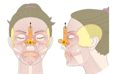 郑大一附院整形科拉皮怎么样?分享真人拉皮整形恢复过程日记+价格表收费