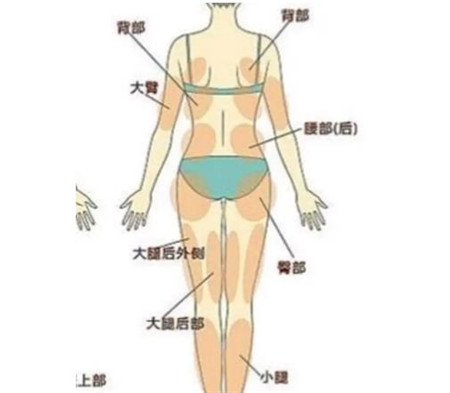 抽脂术后皮肤会因为脂肪流失而下垂吗