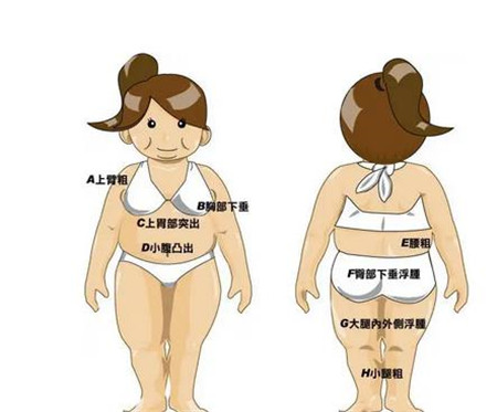 背部吸脂术有哪些适应症及并发症
