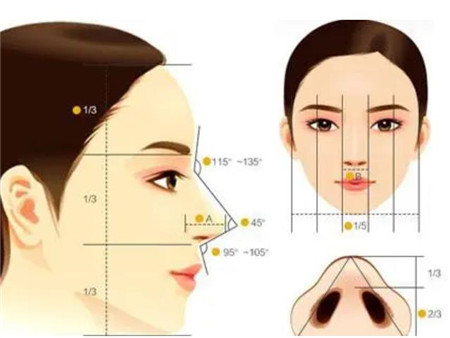 玻尿酸隆鼻有可能失败吗?副作用有哪些