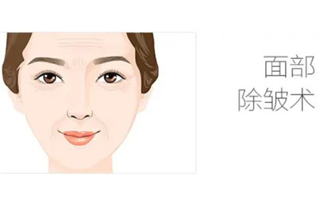 魏广运医生做拉皮怎么样？分享真人整形恢复过程日记+价格表收费
