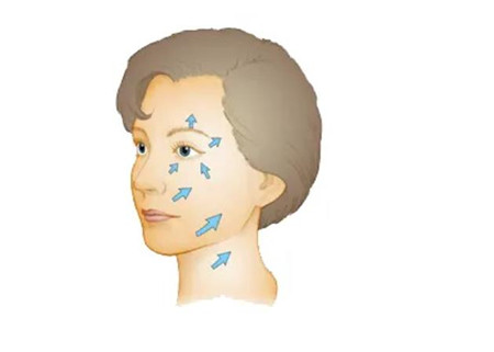 激光去除鱼尾纹有效吗，效果如何
