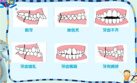 昆明德韩口腔医院牙齿矫正怎么样？做牙齿矫正真实案例反馈/想做的朋友来看看吧！！