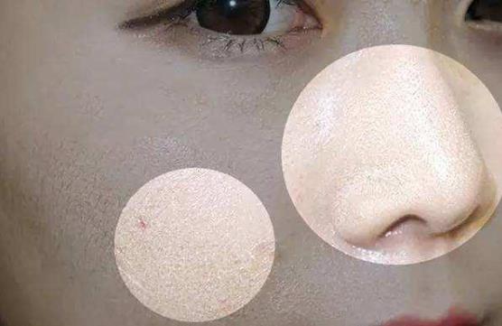 如何养厚角质层：肌肤防御力的秘密武器