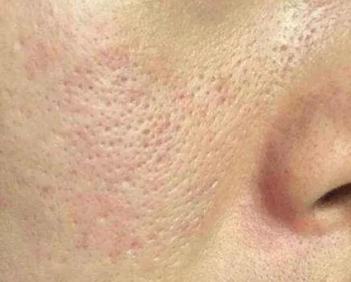 收缩毛孔护肤品是智商税吗？