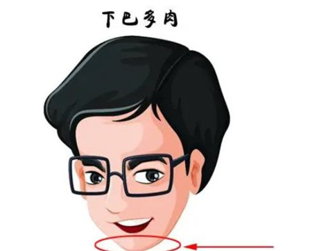 下巴注射玻尿酸后有哪些注意事项