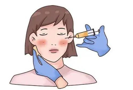玻尿酸隆鼻有哪些优点和缺点