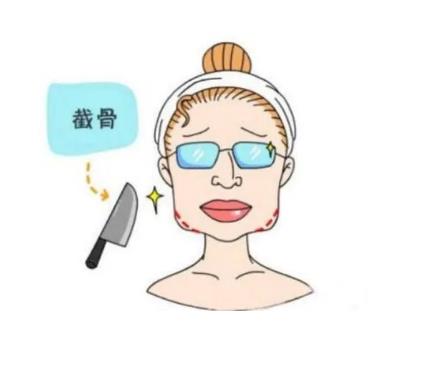 下颌角截骨术的特点是什么，风险有哪些