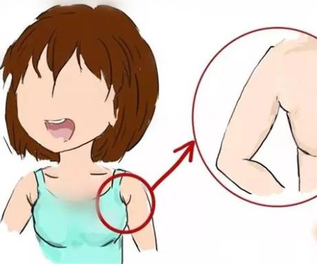 切除副乳有必要吗?效果是永久性的吗