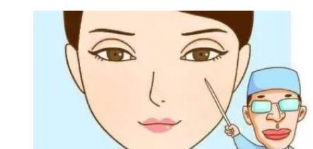 开眼角后的增生会消失吗?