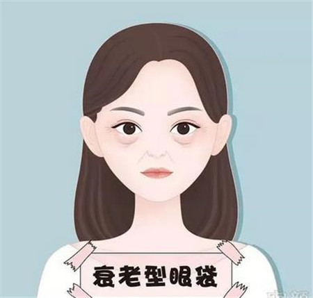 无痕去眼袋有什么优点?哪些人群适合