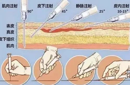 点阵激光有哪些优点和缺点?
